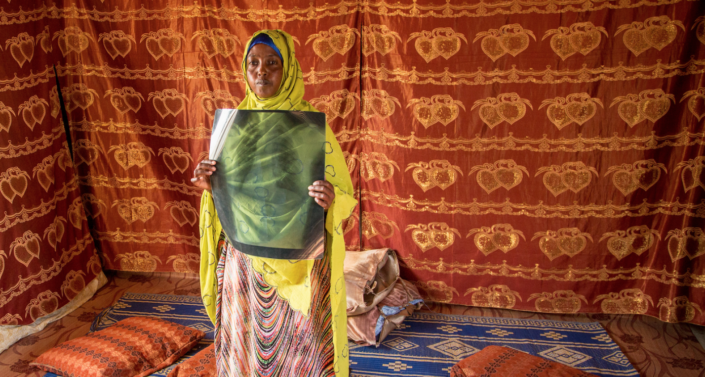 TB campaign in Djibouti, woman holding up x ray image