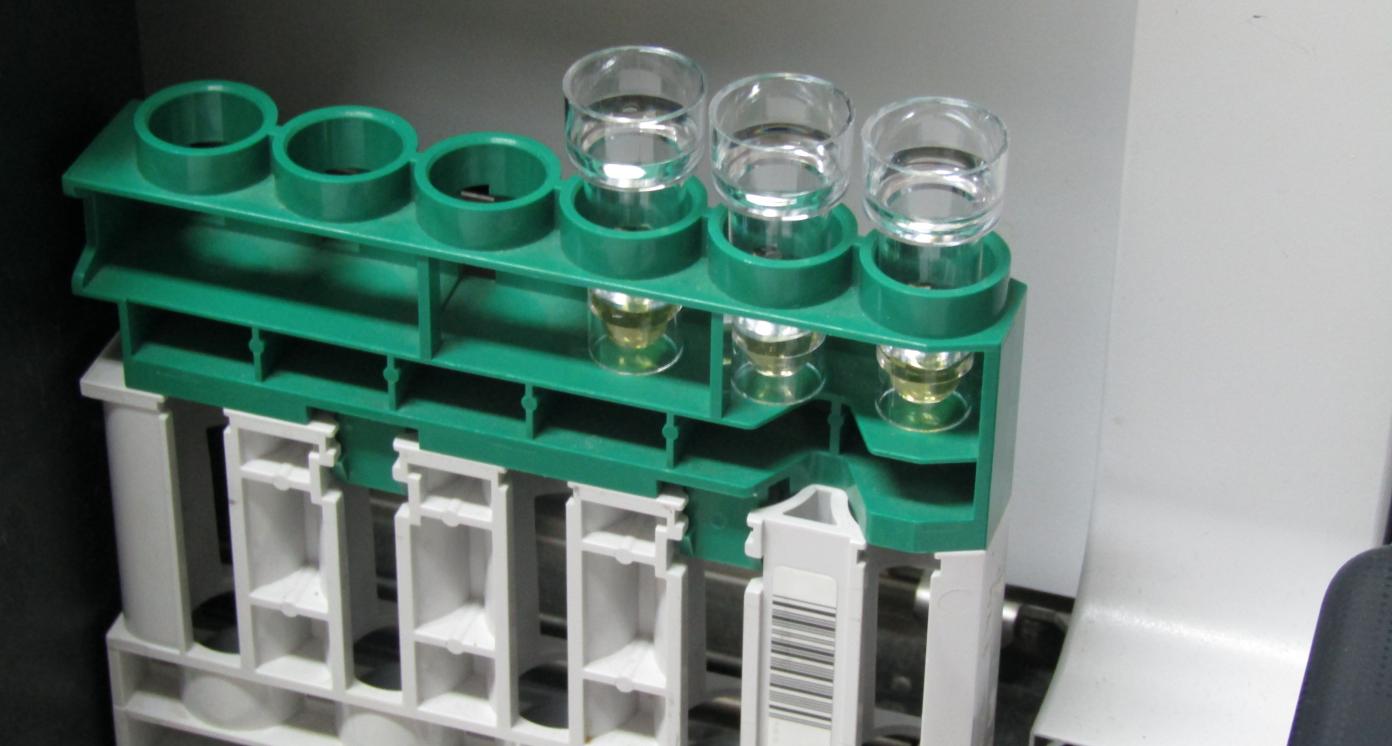 Test tubes in a clinic