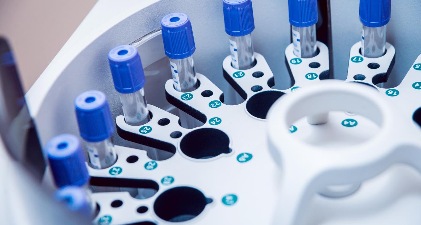 Individual medical samples in PCR machine